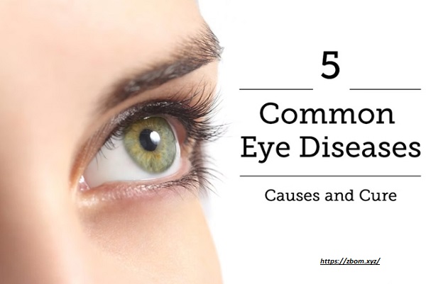 Eye Problems White Siberian huskies