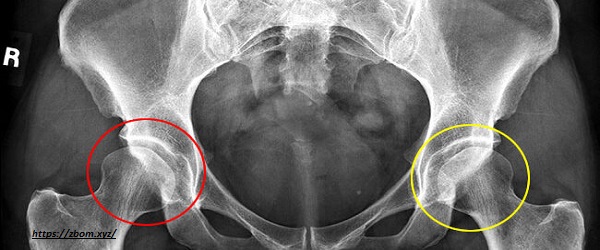 Hip Dysplasia White Siberian huskies