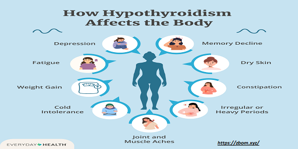 Hypothyroidism of White Siberian huskies White Siberian huskies